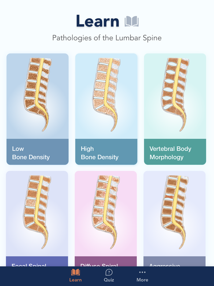 CTisus L-Spine Pathology