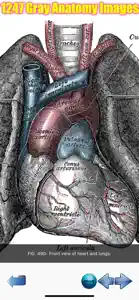 Visual Anatomy Lite screenshot #6 for iPhone