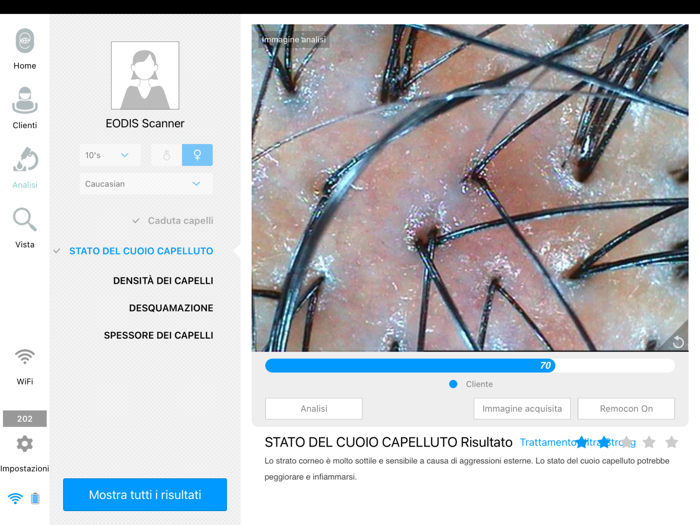 EODIS Hair and Scalp Scanner