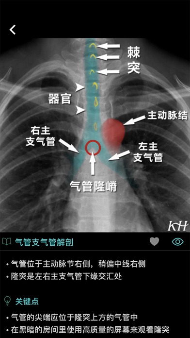 影像图谱のおすすめ画像6