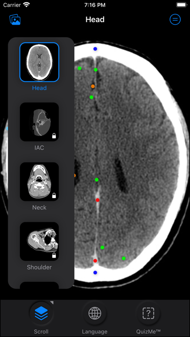 CT Anatomy Screenshot