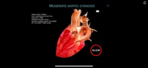 TheHeartPhysiologyApp screenshot #7 for iPhone