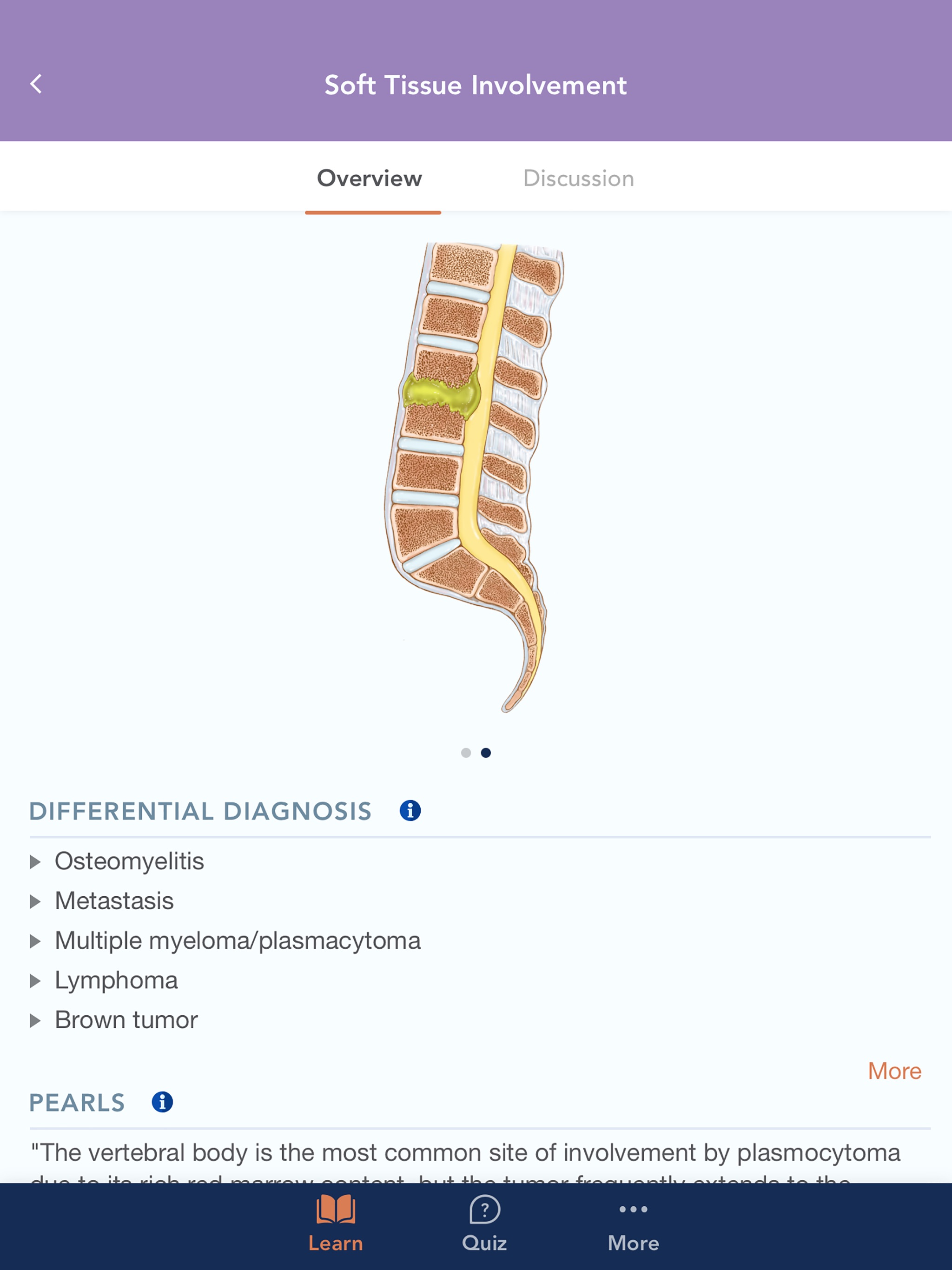 CTisus L-Spine Pathologyのおすすめ画像2