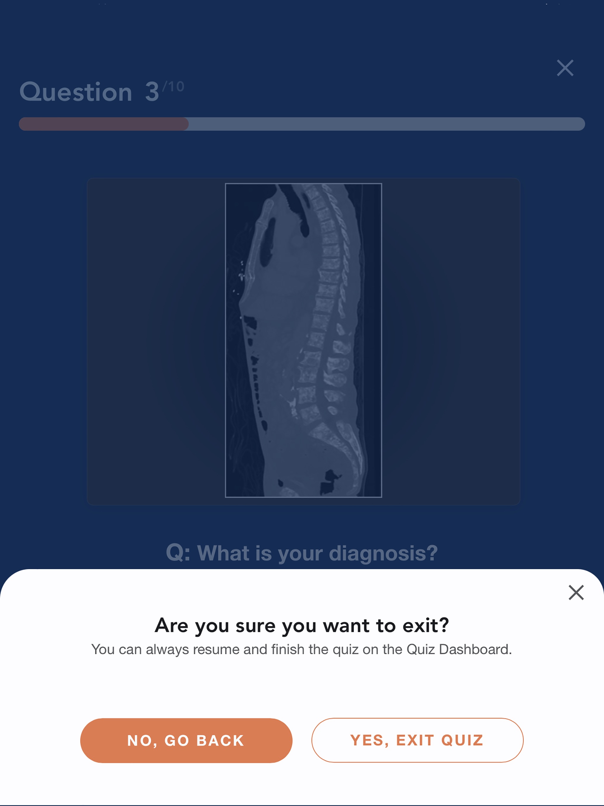 CTisus L-Spine Pathologyのおすすめ画像8