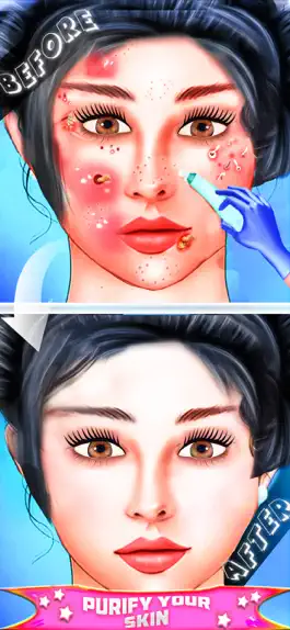Game screenshot ASMR Beauty Skin Treatment mod apk