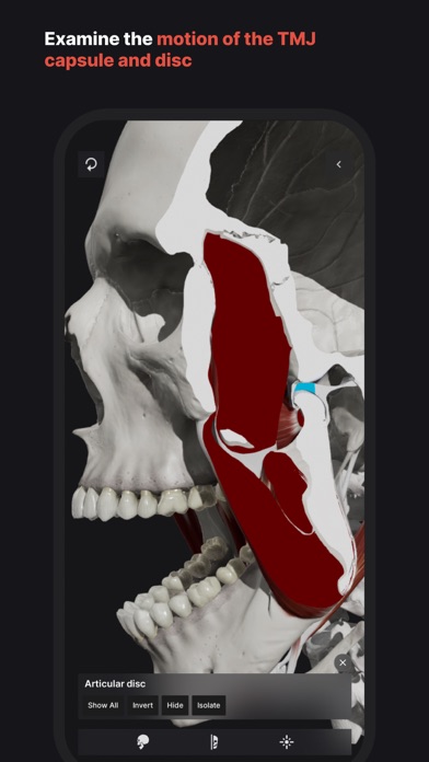 Skull, Teeth & TMJのおすすめ画像6