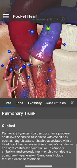 Game screenshot Pocket Heart hack