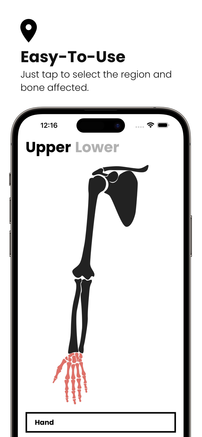 Fractures Splinting App