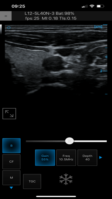 Ultrasound Touch Screenshot