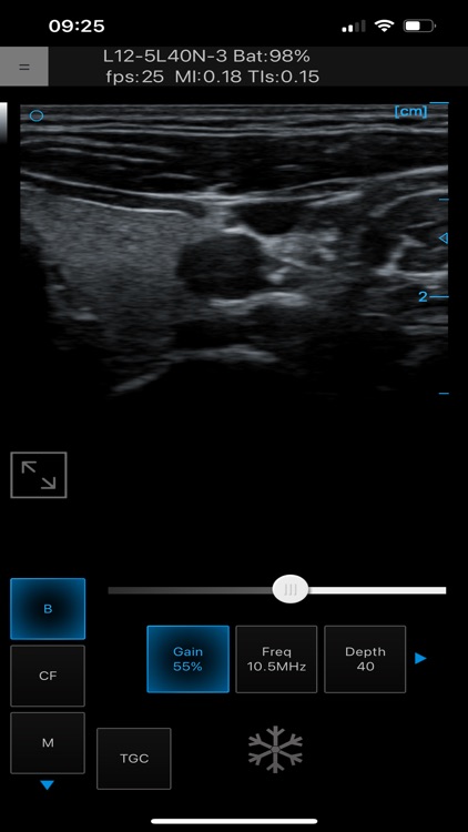 Ultrasound Touch