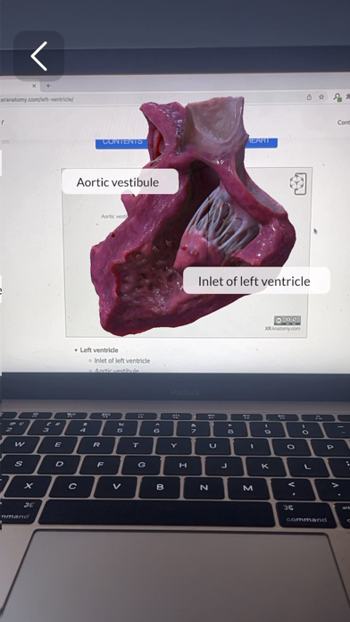 XR Anatomyのおすすめ画像7