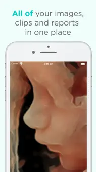 Pim - Your Medical Images iphone bilder 1