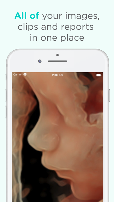 Pim - Your Medical Images Screenshot