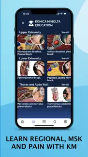 ultrasound educational app iphone screenshot 2