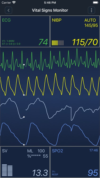 SciChart Examples screenshot-4
