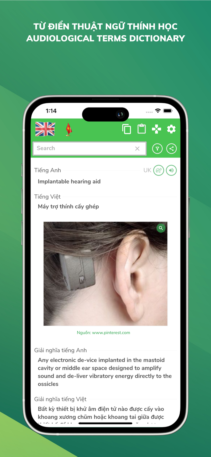 Từ điển Thuật ngữ Thính học