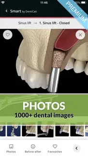 denticalc - the dental app problems & solutions and troubleshooting guide - 3