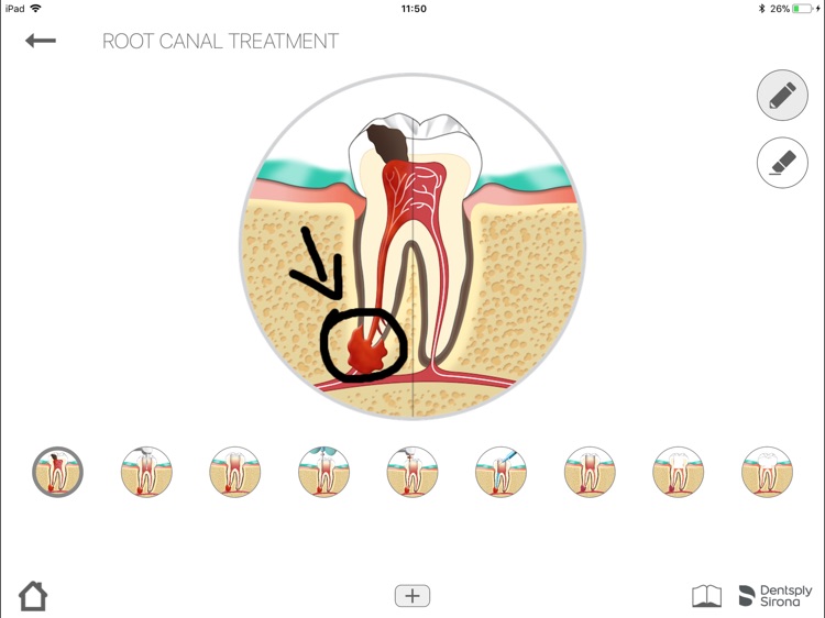 Endo IQ® App - Peru screenshot-6