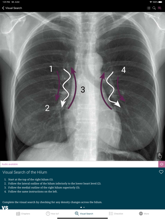 Chest X-ray Interpretationのおすすめ画像10
