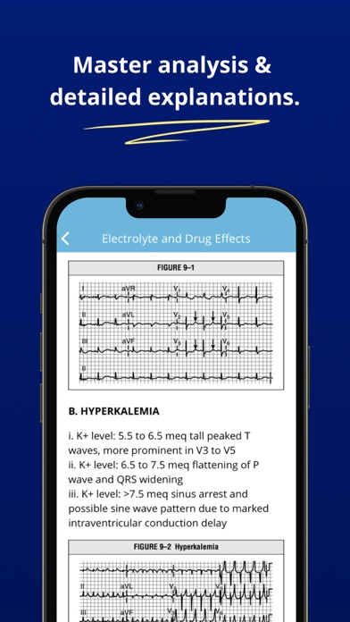 ECG EKG Interpretation Mastery Screenshot
