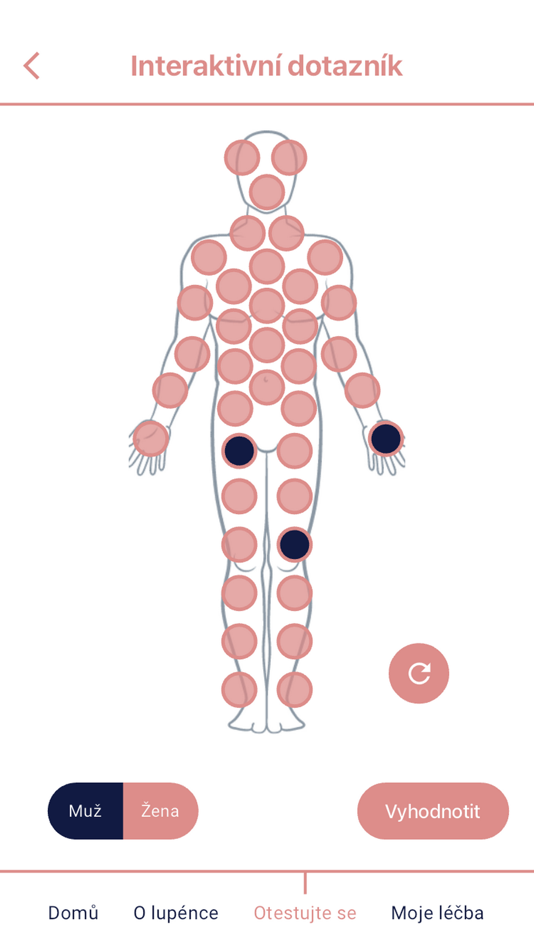 #6. Lupénka (iOS) 由: Pears Health Cyber