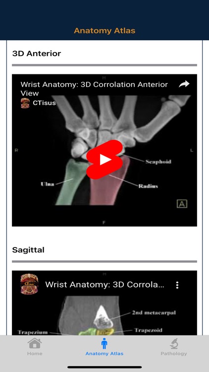 CTisus: CT of the Hand & Wrist screenshot-4