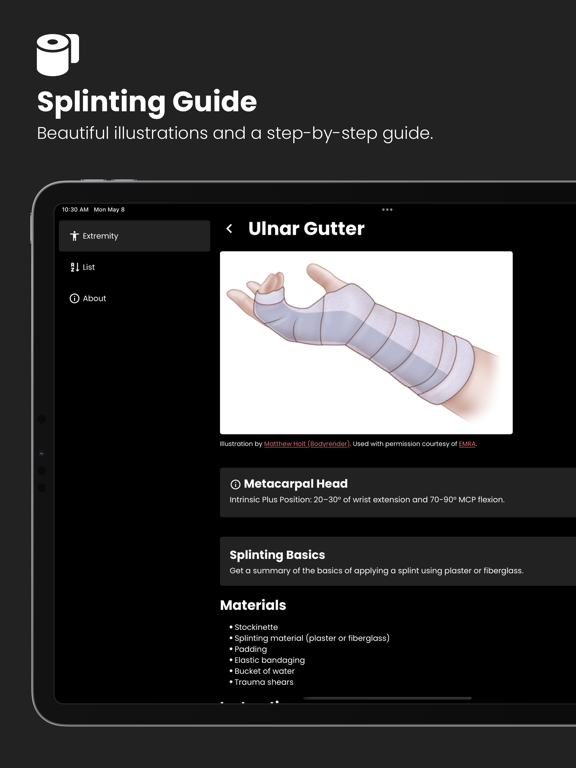 Fractures: Splinting Appのおすすめ画像4