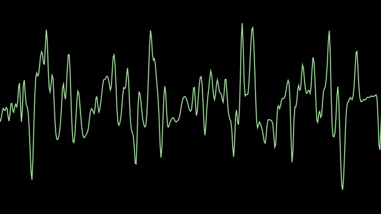 Scope AUv3 Visualizer