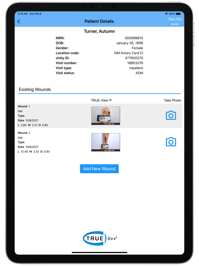 TRUE-See® Mobile App