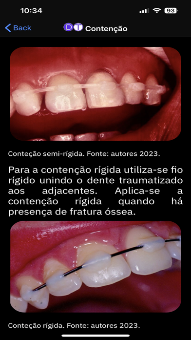 Dental Trauma Screenshot