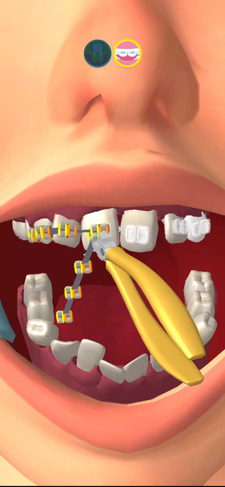 Tips and Tricks for Perfect Smile