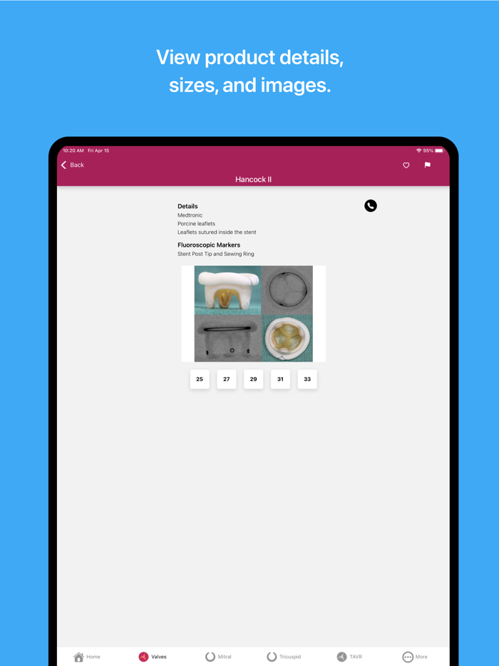 Valve In Valve Mitral