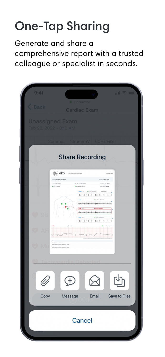 Eko Digital Stethoscope  ECG