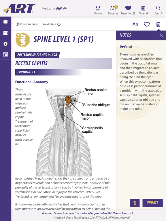 Screenshot #6 pour ARTManII