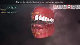 How to cancel & delete incredible human teeth 2