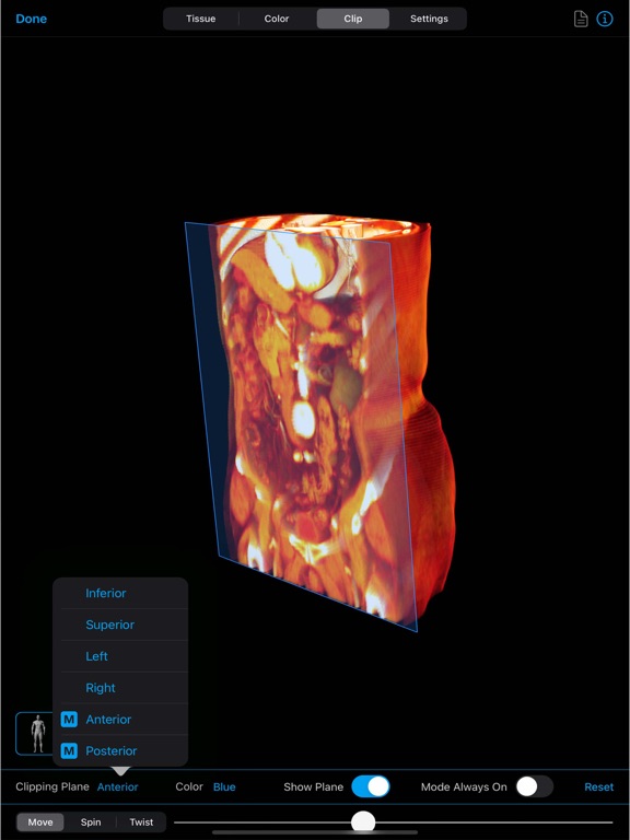 BodyViz iPad screenshot 7 - Medical app