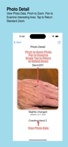 DermShot2 screenshot #4 for iPhone
