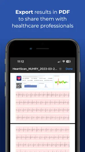 HeartScan: Heart Rate Monitor screenshot 2