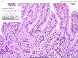 Game screenshot Small Intestinal Pathology hack