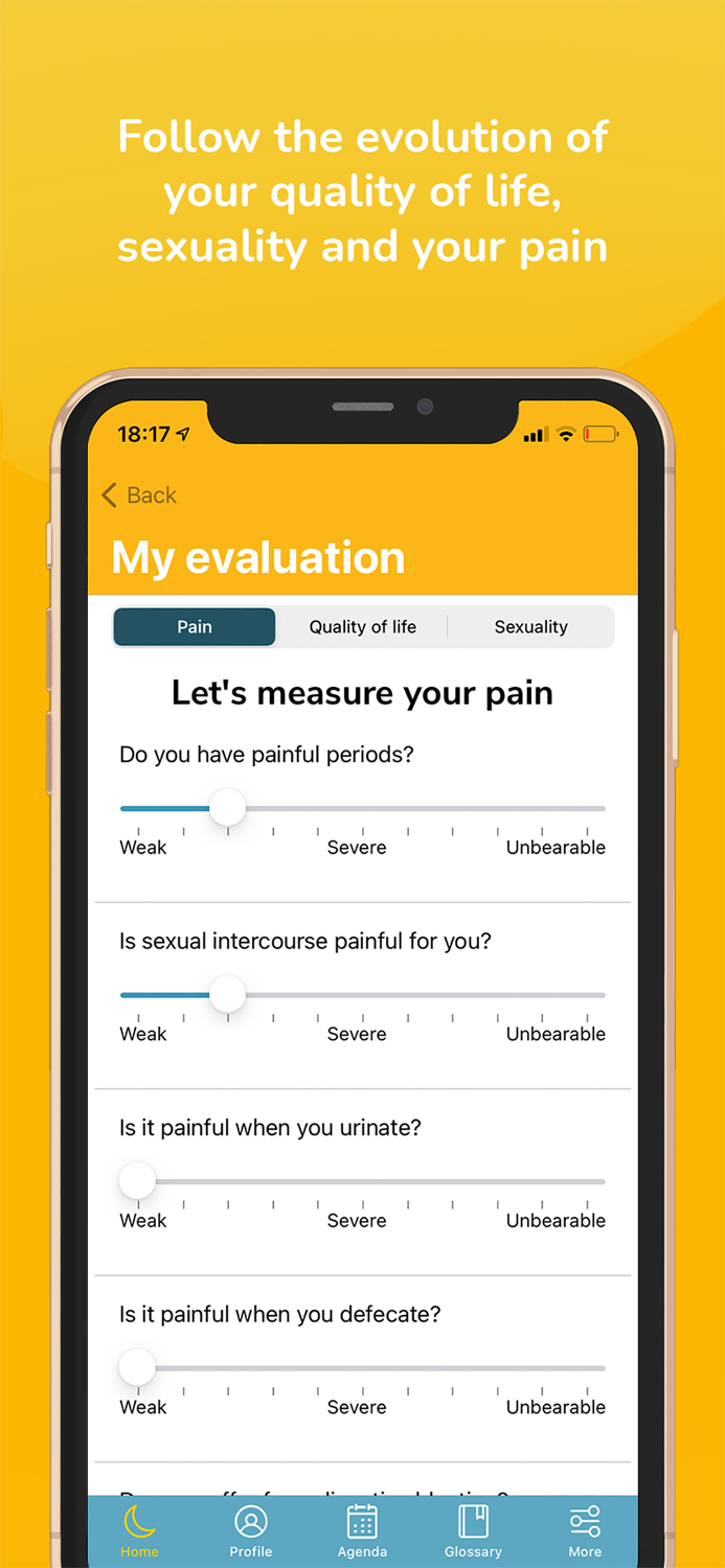 LUNA - Endometriosis