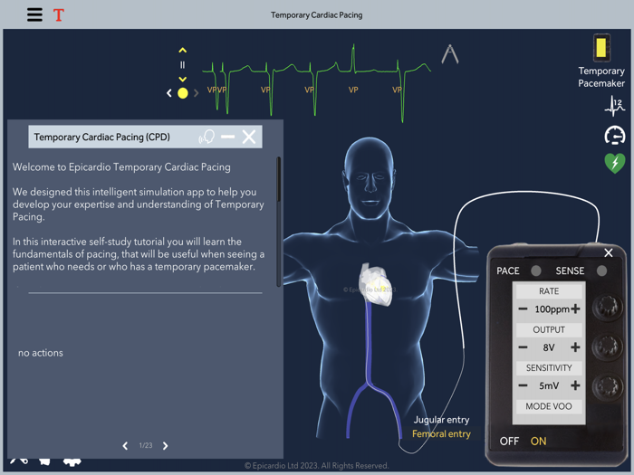Temporary Cardiac Pacing