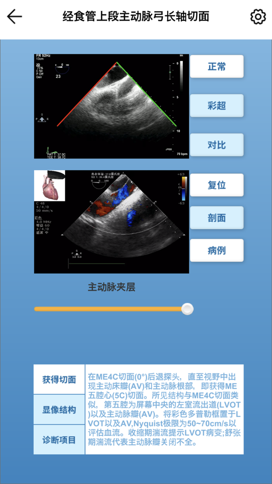 #4. 维思模TEE (iOS) Με: Qiang Meng