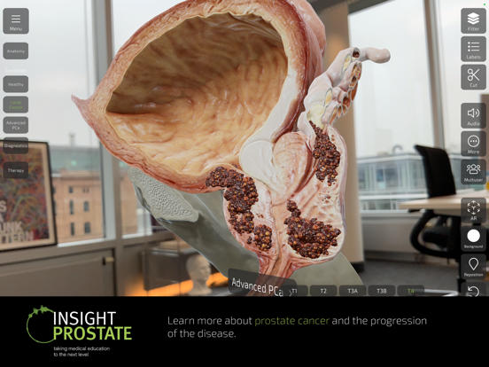 INSIGHT PROSTATE Screenshots