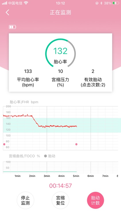 Fetaphon Home - 智能母婴安全监护 screenshot-4
