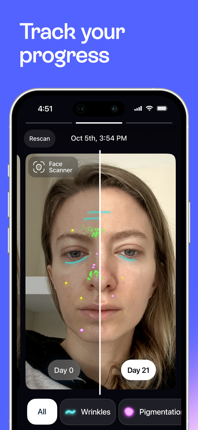Lovi - Cosmetic scanner