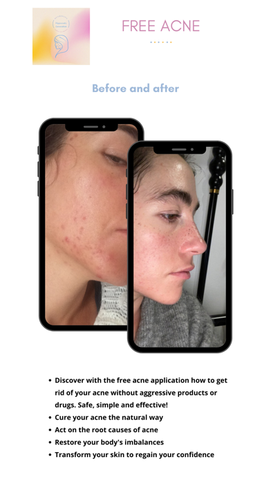 FREE ACNE Screenshot