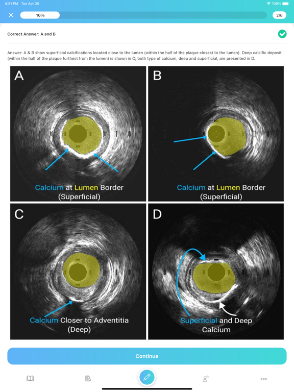 IVUSAID iPad screenshot 6 - Medical app