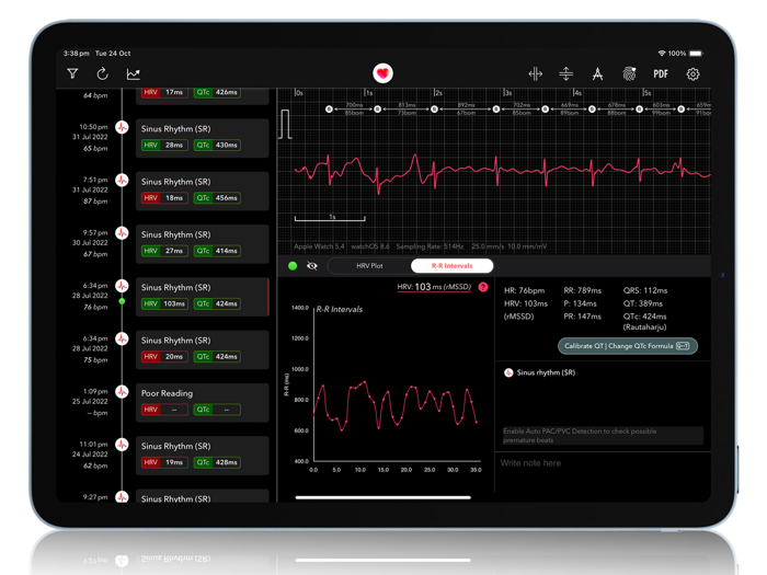 ECG  Analyzer for QTc and HRV