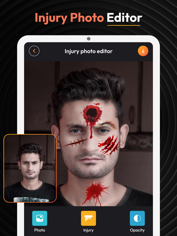 Injury Photo Editor