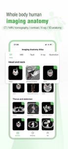 Imaging Anatomy Atlas screenshot #1 for iPhone